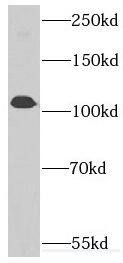 DKFZP434B168 Antibody - BSA Free
