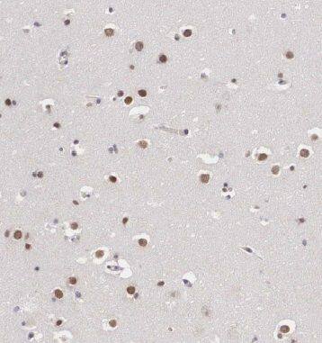 DKFZP434B168 Antibody - BSA Free