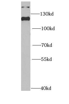 INTS5 Antibody - BSA Free