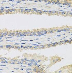 INSL3 Antibody - BSA Free