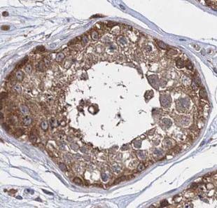 INPP5E Antibody - BSA Free