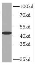 INPP5A Antibody - BSA Free