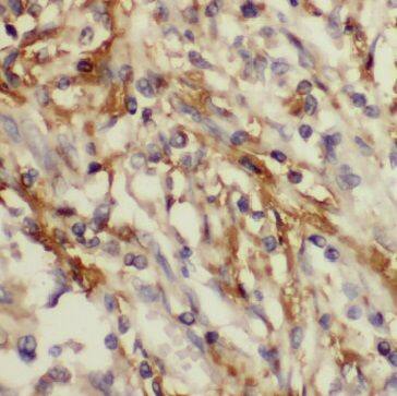 IMMP2L Antibody - BSA Free