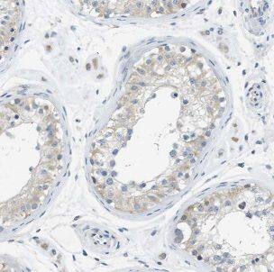 IFT122 Antibody - BSA Free