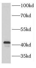 FANCL Antibody - BSA Free