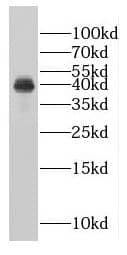 FAM84B Antibody - BSA Free
