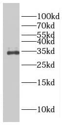 FAM78A Antibody - BSA Free