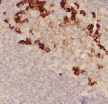 FAM78A Antibody - BSA Free