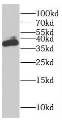 FAM76A Antibody - BSA Free