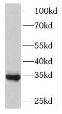 FAM71E2 Antibody - BSA Free