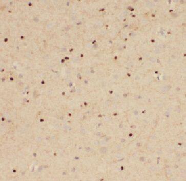 FAM71E2 Antibody - BSA Free