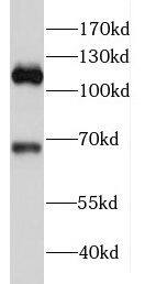 FAM65B Antibody - BSA Free