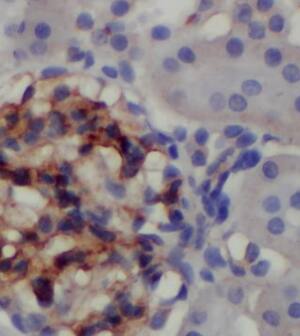 FAM164C Antibody - BSA Free