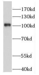 FAM160B1 Antibody - BSA Free