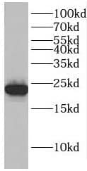 FAM158A Antibody - BSA Free