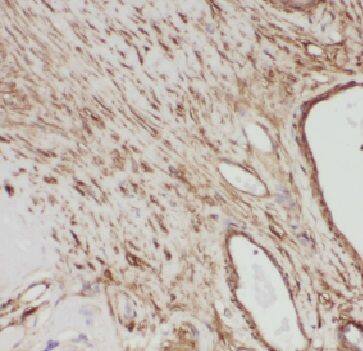 FAM158A Antibody - BSA Free