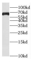 FAM13A Antibody - BSA Free