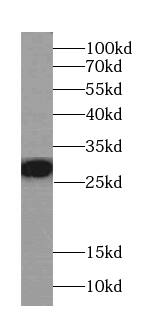 Factor XII heavy chain Antibody (4E7) - BSA Free