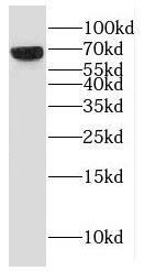 ESCO2 Antibody - BSA Free