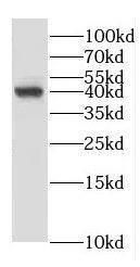 ERLIN1 Antibody - BSA Free