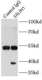 ERLIN1 Antibody - BSA Free