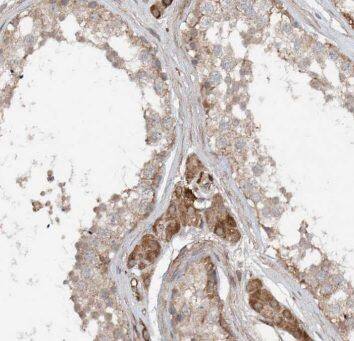 ERLIN1 Antibody - BSA Free