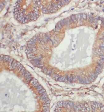 ERGIC1 Antibody - BSA Free