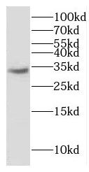 ERGIC1 Antibody - BSA Free