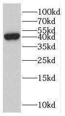 Epithelial Stromal Interaction 1 Antibody - BSA Free