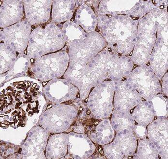 Epithelial Stromal Interaction 1 Antibody - BSA Free
