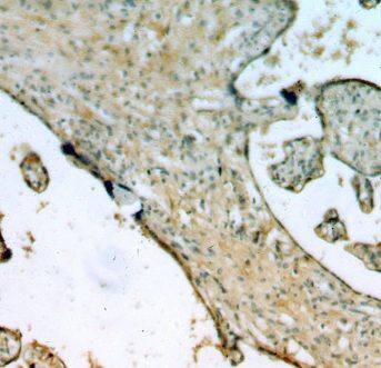 EPS8L2 Antibody - BSA Free