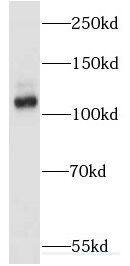 EPB41L1 Antibody - BSA Free