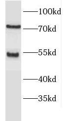 ENTPD8 Antibody - BSA Free