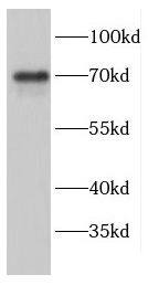 ENTPD4 Antibody - BSA Free
