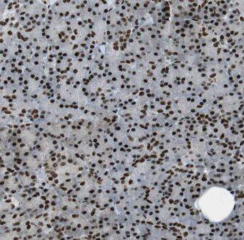 ENC1 Antibody - BSA Free
