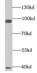 EML1 Antibody - BSA Free