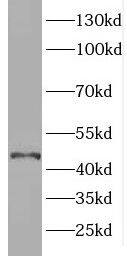 ELOVL6 Antibody - BSA Free