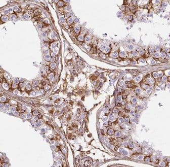 ELOVL2 Antibody - BSA Free