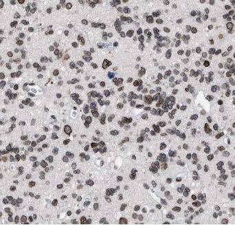 ELMOD1 Antibody - BSA Free