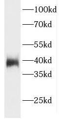 ELMOD1 Antibody - BSA Free