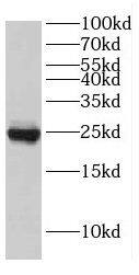 EIF4E3 Antibody - BSA Free
