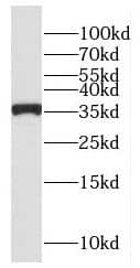 TRIP1 Antibody - BSA Free
