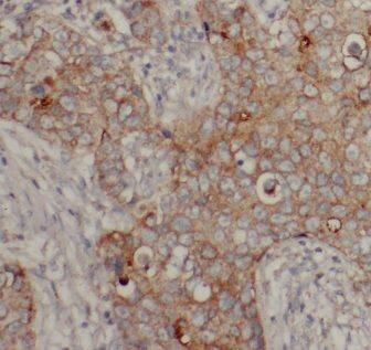 TRIP1 Antibody - BSA Free