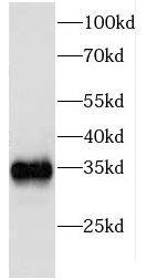 eIF2B1 Antibody - BSA Free