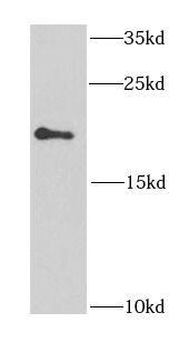 EIF1AY Antibody - BSA Free