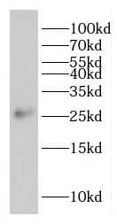 EIF1AD Antibody - BSA Free