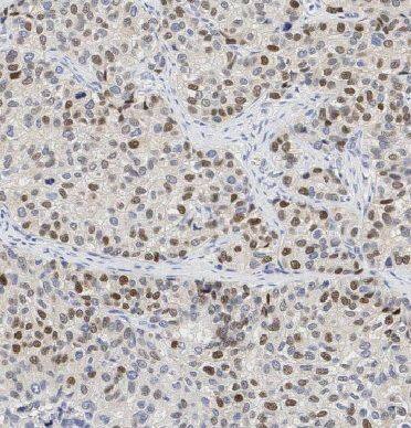 EID1 Antibody - BSA Free
