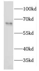 EEPD1 Antibody - BSA Free
