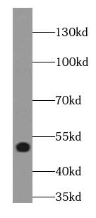 LPAR3/LPA3/EDG-7 Antibody - BSA Free