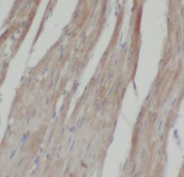 LPAR3/LPA3/EDG-7 Antibody - BSA Free